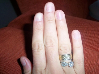 Küt Tırnak Özellikleri ve Faydaları Nelerdir?